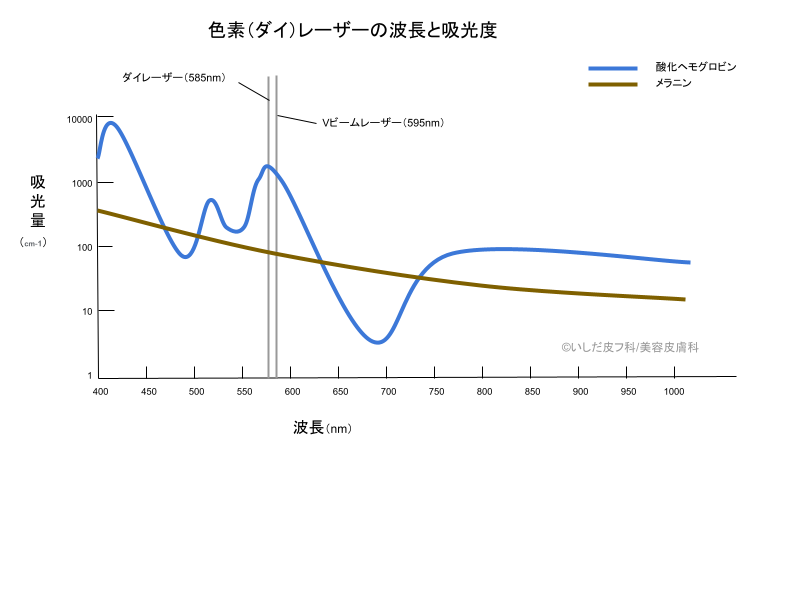 色素（ダイ）レーザーの波長と吸光度
